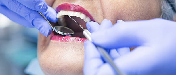 Best Emergency Dental Care for Broken or Chipped Teeth in Venice, FL